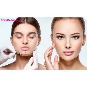 rejuvenare faciala cu botox acid hialuronic si fire pdo4 Rejuvenare faciala cu Botox, Acid Hialuronic și Fire PDO