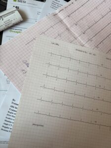 Cardio(logia) și ”provocările” mele.jpg Sursa: pexels cardio
